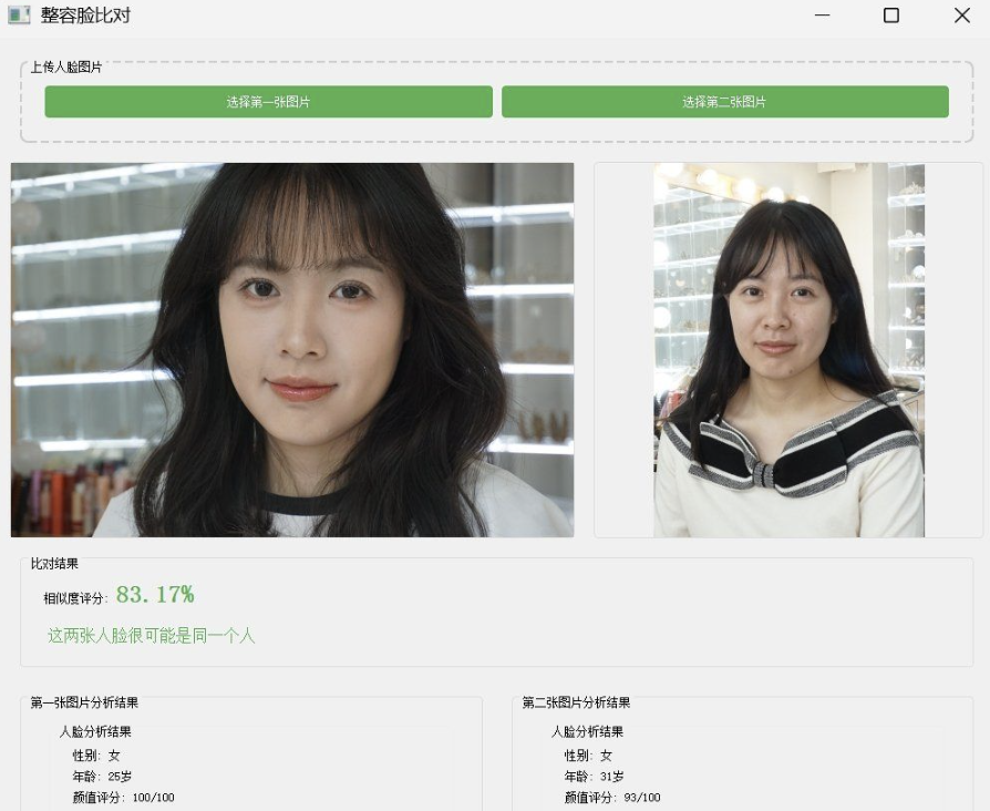 整容脸比对系统